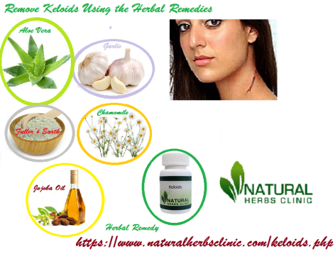 Keloids Herbal Remedies