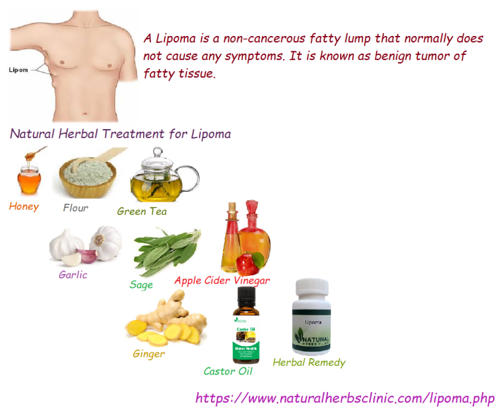 Natural Herbal Treatment for Lipoma